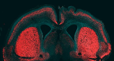 Giza garuna handitzea eragiten duen gene bat eta gene erregulatzaile bat identifikatu dituzte