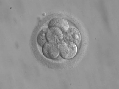 Lehenaldiz enbrioiak genetikoki eraldatzeko teknika bat probatu dute giza enbrioetan